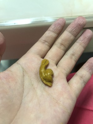 【彻底清洗清理小龙虾】简单又干净