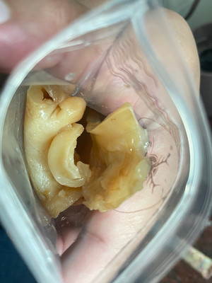 养生早餐：花胶人参铁皮石斛灵芝汤